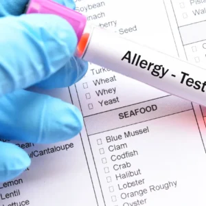 allergies_optimized